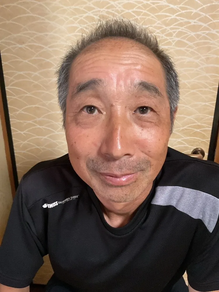 左顎関節症（頭蓋骨の調整・薄毛の変化こうご期待）