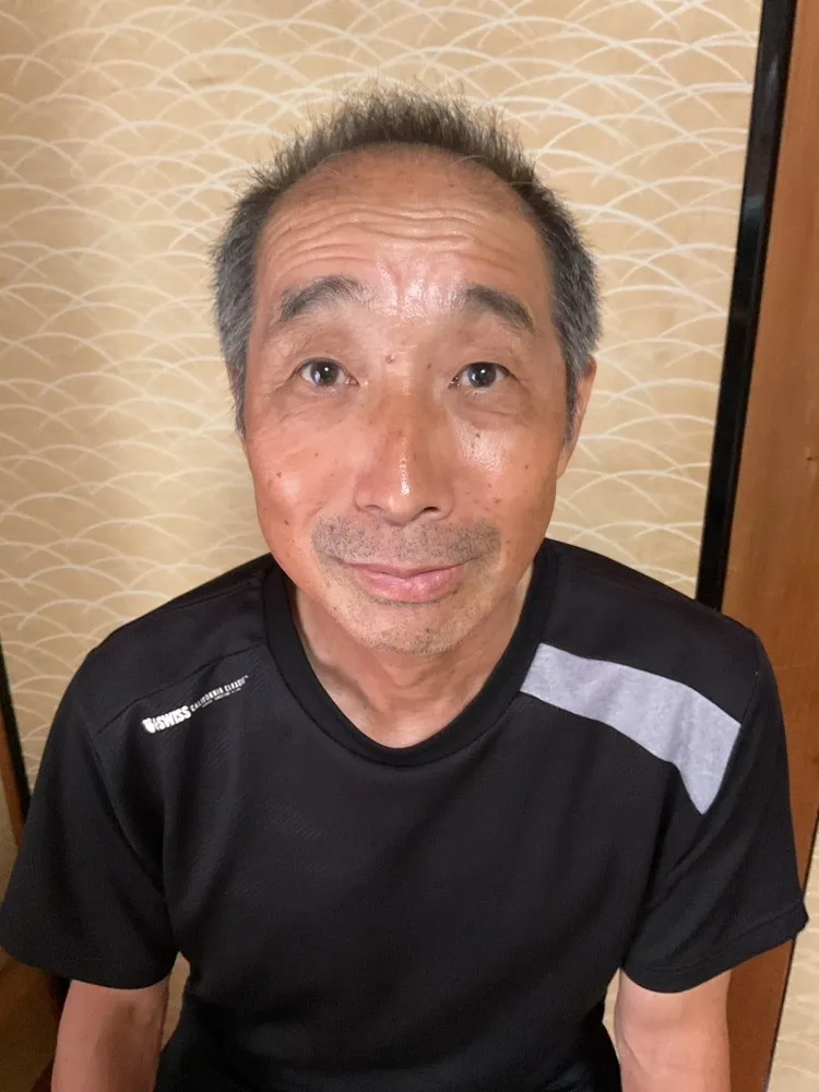 左顎関節症（頭蓋骨の調整・薄毛の変化こうご期待）